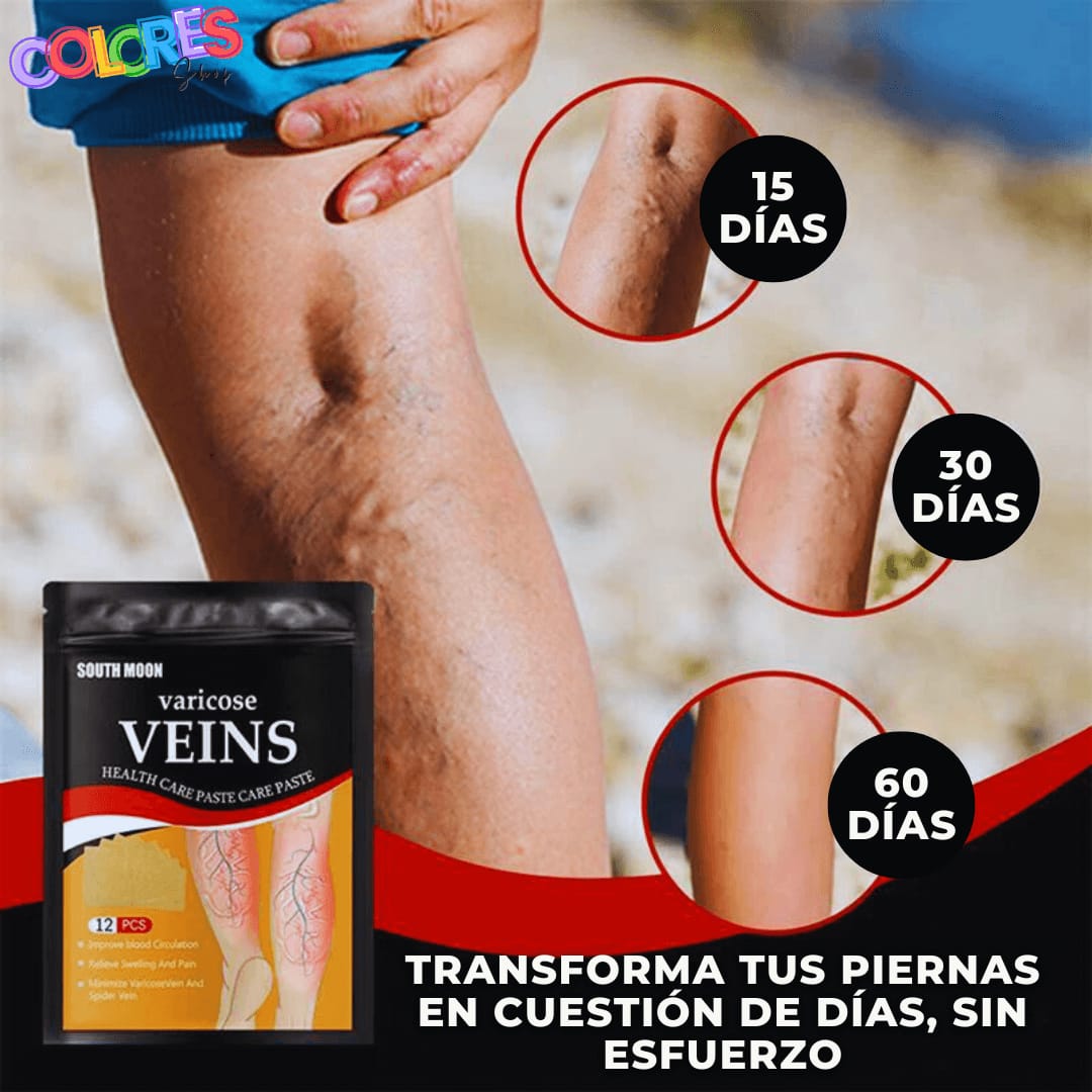 Parches Circulatorios para Várices : Alivio de hinchazón y dolor